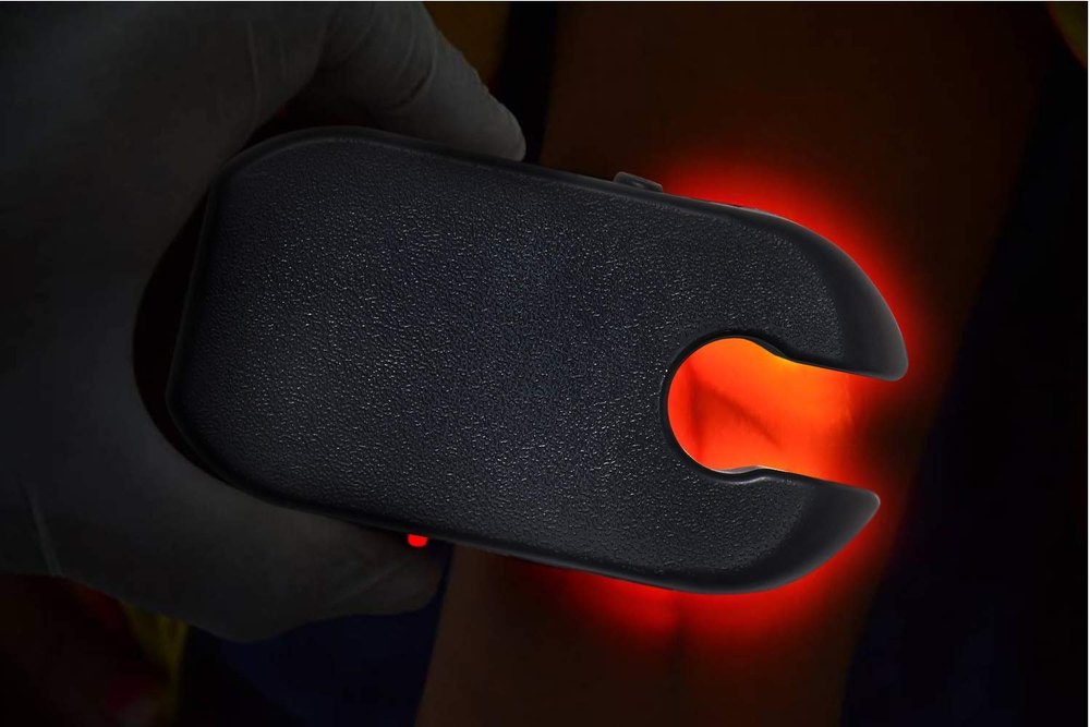 MCP Vein Finder Device for Adults & Children – Portable LED Vein Viewer for Clinical Use (Black)